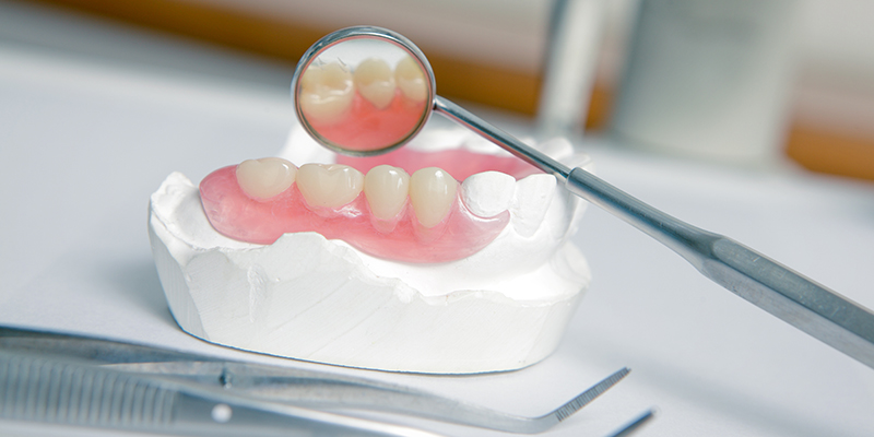 再根管治療も歯内療法の目的に応じて行います