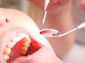 歯医者に通う正しい頻度は？定期検診の最適な頻度と主な内容について